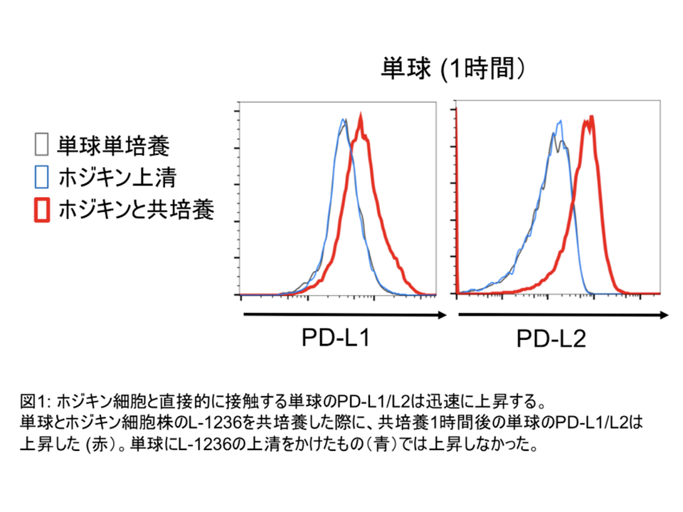 ホジキンリンパ腫に抗PD-1抗体が効く仕組みへの提言〜がん細胞の